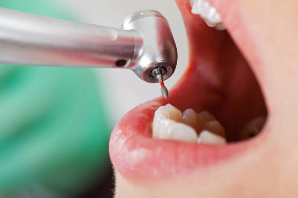 Best Walk-In Emergency Dentist in Ptland, OR